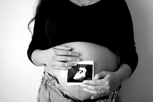 Accouchement sans péridurale : comment bien se préparer ?